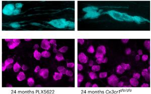 《Nature Neuroscience》大腦白質為何隨年齡退化?因為免疫細胞“勾心斗角” 《Nature Neuroscience》大腦白質為何隨年齡退化?因為免疫細胞“勾心斗角”