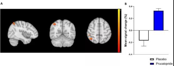 ?牛津科學家發現:通便也能通記憶,這種藥物或可促認知作用 ?牛津科學家發現:通便也能通記憶,這種藥物或可促認知作用