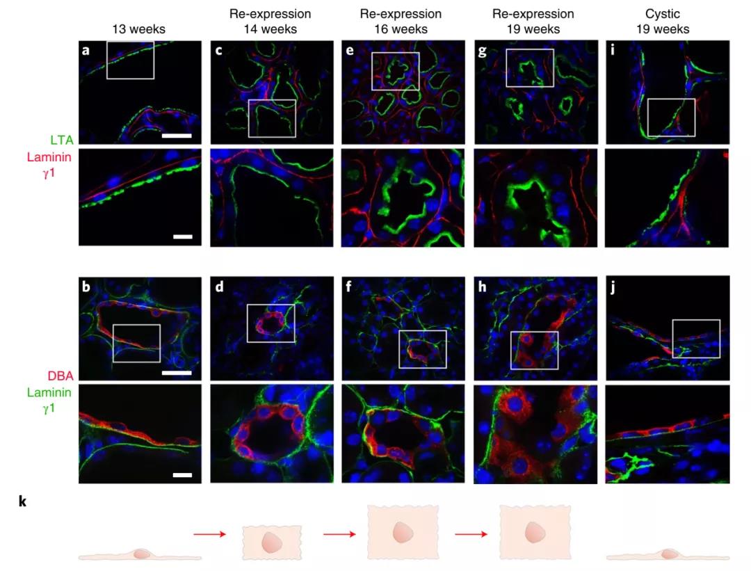 無需腎移植!Nature子刊:科學家通過逆轉小鼠多囊腎病揭示腎臟的可塑性