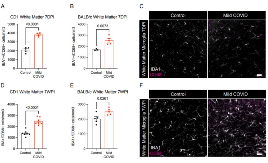新冠竟能“傷腦”?耶魯科學家找到SARS-CoV-2損害神經系統新證據