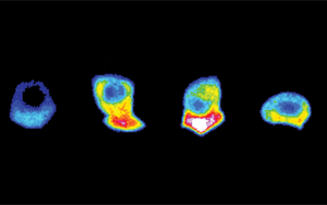 Developmental Cell:為入侵細胞的“前線”提供燃料