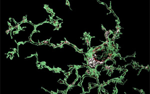 Nature子刊:血管周圍細胞誘發阿爾茨海默病相關的微膠質功能障礙