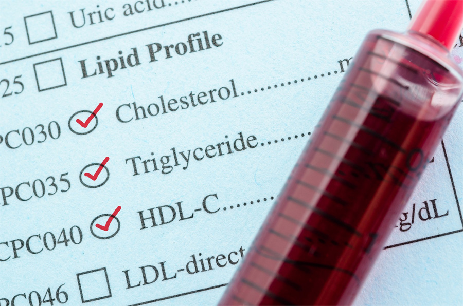 高/低密度脂蛋白膽固醇(HDL /LDL-C)檢測