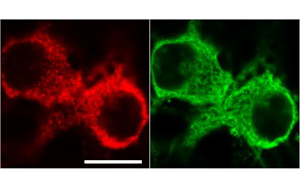 《PNAS》從過度反應蛋白合成到認知障礙，敲除1個基因即可