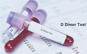 D-二聚體(D-Dimer)-磁微粒化學發光法(吖啶酯) /熒光免疫層析解決方案