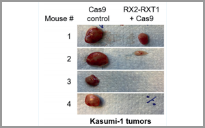 Leukemia:基于CRISPR的基因療法為白血病治療帶來希望