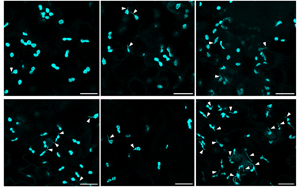 Science Advances:葉綠體的作用不僅僅是光合作用!免疫防御中隱藏的玩家