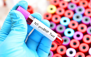 氨基末端腦利鈉肽前體(NT-proBNP)-熒光免疫層析解決方案