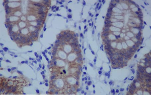 《PNAS》一種不為人知的蛋白質，它能保持人體細胞的健康