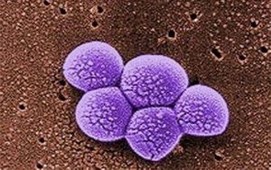 《Science》突破性新抗生素,遏制耐藥細菌