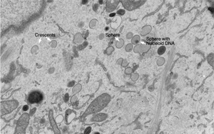 Nature Microbiology：一種以前未知的免疫反應(yīng)途徑
