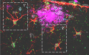 《Nature Neuroscience》可增強神經膠質細胞的蛋白質 《Nature Neuroscience》可增強神經膠質細胞的蛋白質